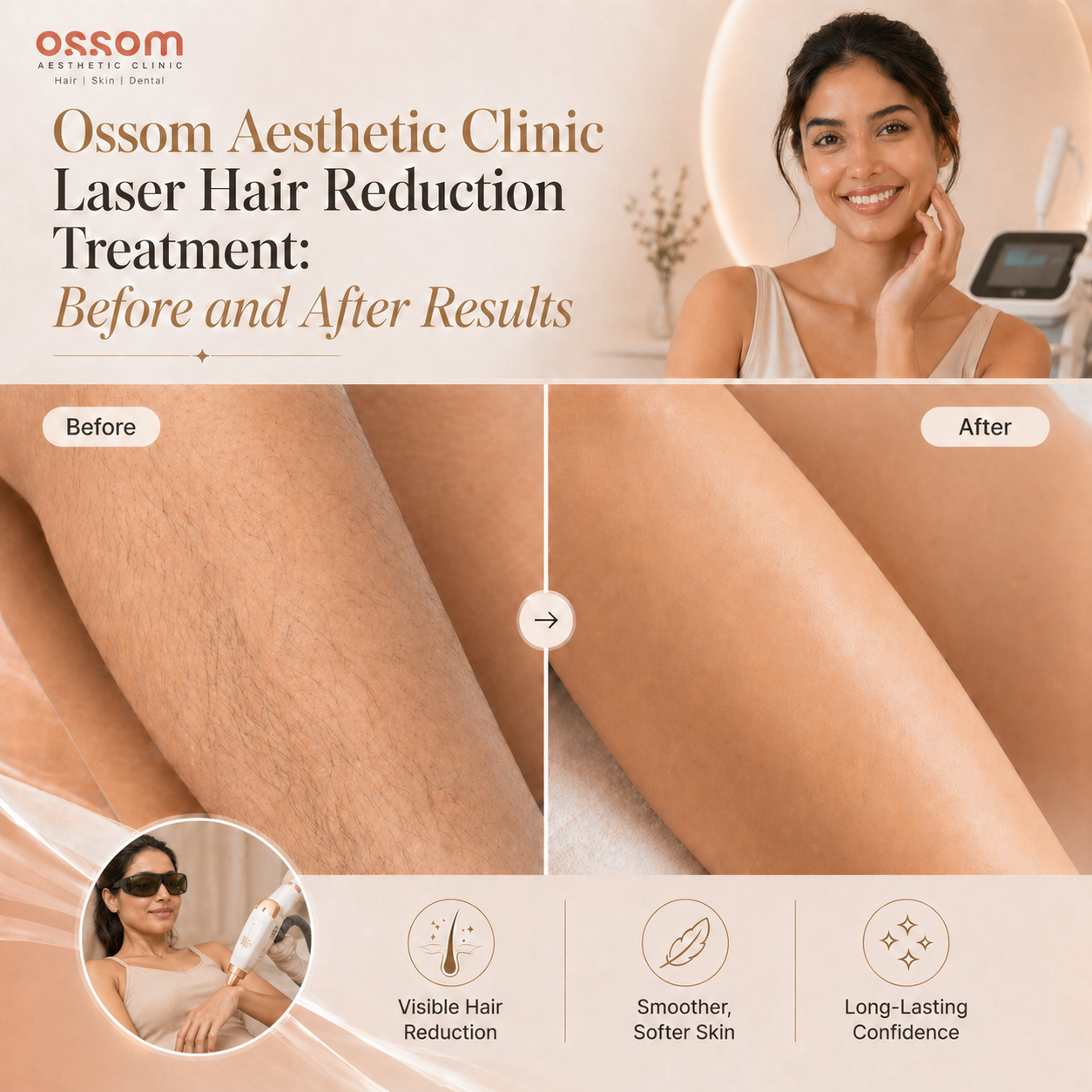 Laser reduction treatment before and after results